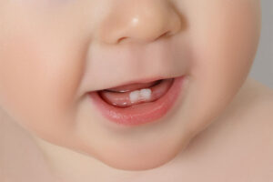 赤ちゃんの歯について